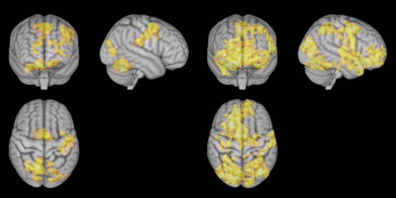 Different meditation practices produce different brain response